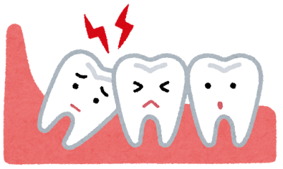 Three cartoon teeth with distressed faces on pink gums, red lightning bolts above—depicting toothache or dental pain.